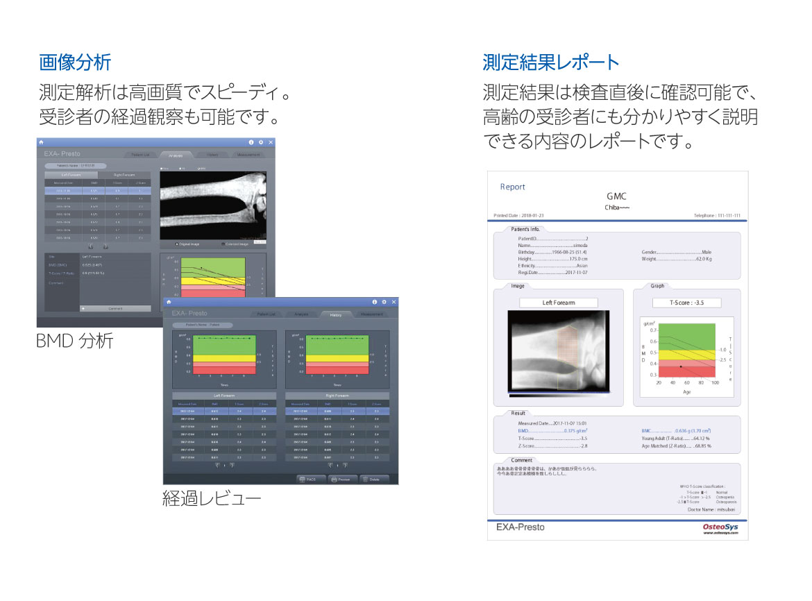 測定解析は高画質でスピーディ。経過観察も可能。測定結果は検査直後に確認可能で、高齢の受診者にも分かりやすく説明できる内容のレポートです。 画像分析と測定結果レポート